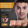 Charmonic Blackhead Pore Strips, 33 pcs Charcoal Peel Off Strips, Blackhead Remover Pore Strips for Men, Deep Cleansing Strips Remove for Nose Area and Face Oil and Blackheads view 3
