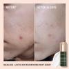 BIOSSANCE Squalane + Lactic Acid Resurfacing Night Serum - Vegan 10% Lactic Acid Face Serum for Skin Texture and Fine Lines - Gentle Night Exfoliant, Hydrating - Pore Reducer for Face, 1.0 Ounce view 2