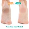 GILDEN TREE Urea Gel 42 Percent For Feet Maximum Strength Softens Cracked Heel Calluses & Thick Toenails view 2