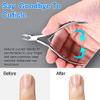 8 Pieces Cuticle Trimmer Stainless Steel Cuticle Nippers Pointed Blade Dead Skin Cutter Clipper Remover Scissors Manicure Tools for Fingernails and Toenails(Silver) view 4