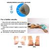 5 Pairs Moisturizing Gel Heel Socks Vented Unisex Toe Open Feet Care Dry Skin view 4