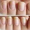 NAILVIVE Nail Serum Powerful Natural Keratin Nail Treatment Silk Proteins Proven Natural Formula Strengthening Hardening nails Instantly Prevents Splits Chips Peels Cracks on Your Nails (Bonus Pack!) view 4