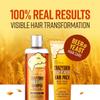 CRAZY SKIN German Beer Yeast Biotin Shampoo & Hair Treatment Set for Anti Hair Loss & Hair Regrowth, Shiny Curl Care 300ml + 200ml Set (16.9Fl oz) view 4