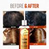 CRAZY SKIN German Beers Shampoo - 20.30 fl oz(300ml) X 2set, BIOTIN for hair loss, Rich with Beer Yeast for Regrowth and Thickening, Sulfate/Chemical free, Suitable for all hair types view 2
