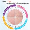 IMENE Permanent Hair Removal Machine for Women & Men, 500,000 Flashes IPL System with Ice Care Function for Full Body Home Use - Safest and Fastest IPL Technology view 2