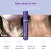 SBLA Neck, Chin & Jawline Sculpting Wand XL  Melts Fat Under The Chin & Along Jowls, Lifts & Sculpts The Entire Neck Area & Reduces Lines, Boosts Collagen Production view 2