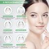 Blackhead Remover Pore Vacuum, [FDA Certification]  WiFi Visible Facial Pore Cleanser with HD Camera Pimple Acne Comedone Extractor Kit with 6 Suction Heads Electric Blackhead Suction Tool view 4