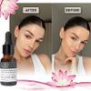 BAO Laboratory Lotus Squalane Healing Facial Oil Hydrates Dry Skin, Rebalances Oily Skin, Soothes Sensitive Skin, Repairs Acne Prone Skin, Everyday Vitamin Rich Moisturizing Facial Oil for Women(15ML) view 3