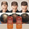 First Botany, Hair Growth Shampoo Conditioner Set - An Anti Hair Loss Biotin Shampoo & Conditioner with DHT blockers to fight Hair Loss For Men & Women, All Hair types, Sulfate Free - 2 x 16 fl oz view 4