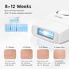 [FDA Cleared] IPL Hair Removal Aimanfun At-Home Laser Hair Removal for Women & Men Painless Permanent Hair Remover Device for Body Face Corded,White,2 Years Warranty view 4