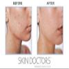 #MC SKIN DOCTORS GAMMA HYDROXY CREAM 50ML -Gamma Hydroxy help to renew skin complexion in just 2 weeks reducing acne scarring, blackheads and whiteheads as well as skin pigmentation view 3