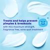 Clean & Clear PersaGel 10 Acne Medication Spot Treatment with Maximum Strength 10 Benzoyl Peroxide Topical Pimple Cream Acne Gel medication for Face Acne with Benzoyl Peroxide, (pack of 4) view 3