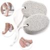 AnHua 2 Pcs Pumice Stone Hard Dead Skin Callus Scrubber Remover Pedicure Manicure Nail Tools Professional Pedicure Foot Care Tools view 4