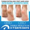 Imperial Feet Foot Balm Blue - Cream for Dry Skin - for Dry feet - Dry and Cracked Feet - Rosemary & Eucalyptus - 150ML view 2