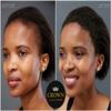 CROWN Hair Building Fibers Multipack (2 x 28g) - Instantly Cover Fine & Thinning Hair for a Thicker, Fuller Look - A Natural Keratin Concealer - 13 Shades for Men & Women - Black view 4