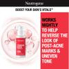 Neutrogena Retinol SA, Stubborn Marks PM Treatment, Face-Exfoliating Treatment to Help Reverse the Look of Post-Acne Marks & Uneven Skin Tone, Non-Comedogenic, PM Treatment, unscented, 1.0 Fl Oz view 2
