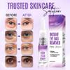 Dermaxgen Instant Under Eye Bag Remover Cream - Dark Circles Under Eye Treatment Cream for Wrinkles & Puffiness - Advanced Anti-Aging Formula for Women - Quick Solution for Tired & Dull Skin - 0.21 OZ view 4