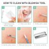 Dr.Pedi Blackhead Remover Pimple Popper Tool Kit Acne Blemish Pimple Extractor Needle Facial Comedone Clip Blackhead Tweezer for Ingrown Hair Removal 8 Pcs in Metal Case view 4