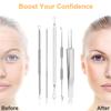9 PCS Blackhead Remover Tools, Pimple Popper Tool Kit & Comedone Extractor - Professional Acne, Zit, Blemish & Whitehead Removal for Face & Nose, with Stainless Steel Tweezers & Travel Case, UUBAAR view 3