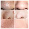 LANBENA Blackhead Remover Mask, Blackhead Remover Mask Peel Off Blackhead Mask 2 in 1 Green Tea Oil Blackhead Removal 100 Pcs Blackhead Remover Mask for Pores, Nose, Chins & Face view 2