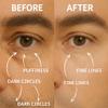 Disco Men's Eye Bag Treatment, Roller Serum for Men, Under Eye Cream Natural Caffeine Anti Aging Stick Balm, Reduce Puffiness, Wrinkles, Dark Circles, Crows Feet, Bags, Dark Circles, Lines, Puffiness view 2