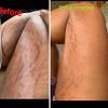 Stretch marks creams 100% organic product view 3