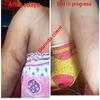 Stretch marks creams 100% organic product view 4