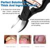 FERYES Precision Toenail Clippers for Thick or Ingrown Toenails - Secure and Stylish Design Thick Nail Clipper - W/Leather Case view 4