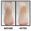 400 Pcs Foot Pumice Callus Remover for Feet Heels and Palm by Creation, Foot Callus Remover, Feet Scrubber Dead Skin, Shower Foot Scrubber, Pedicure Tools, Corn Remover Long-Lasting Beauty Skin Care view 4