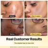 Gleamin Vitamin C Clay Mask for Dark Spots, Turmeric Clay Face Mask Skin Care, Deeply Cleanses & Refines Pores, Brightens Uneven Tone and Helps Improve Post-Blemish Scarring & Texture, Up to 20 Uses view 2