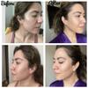 Pro Home Peels Professional Face Chemical Peel for Hyperpigmentation and Dark Spots view 2