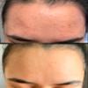 Pro Home Peels Professional Face Chemical Peel for Hyperpigmentation and Dark Spots view 4