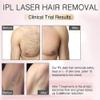 Laser Hair Removal for Woman and Men, Permanent IPL Laser Hair Removal 300,000 Flashes Home Use Hair Remover Device for Bikini, Face, Legs, Arms, Armpits view 4