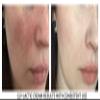 Planet Eden 20% Gly-Lactic Face and Body Skin Cream Lotion - 10% Glycolic and 10% lactic Acid for Exfoliation (8 oz) view 4