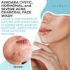 Ayadara Severe Acne Charcoal Face Wash, 3.4 oz, Daily Cleanser with Sulfur and Honey, Face Cleanser for Acne, Deep Cleansing Charcoal Face Wash for Women and Men, 200 Uses view 2