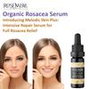 Organic Skin Care - Rosacea Intensive Repair Serum view 2