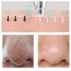 Blackhead Remover Vacuum view 2