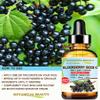 Belgian Elderberry Seed Oil Sambucus Nigra 100% Pure Natural Virgin Unrefined Cold Pressed Carrier Oil 1 Fl. Oz.- 30 ml for FACE, Skin, Hair, Nails, Anti-Aging by Botanical Beauty view 4
