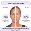 Myotone Professional Microcurrent Facial Toning Kit with Anti-Aging Serum - at-Home Treatment - Lifts and Firms Skin - Reduces Wrinkles view 2