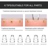 Blackhead Remover Vacuum Pore Cleaner USB Rechargeable Blackhead Removal Tool with 3 Modes and 6 Replacement Probes view 3