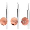 BesYouSel Professional Stainless Pimple Popper Tool Kit, Blackhead Removal Tool,Tweezers Pimple Extractor Acne Removal Tools with Metal Case for Blackheads, Forehead,Facial and Nose,Pack of 5 (Silver) view 4
