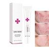 Acne Cream Pimple Cream for Face, Oil Control Pimple Remover Cream Get Rid of Pimples Fast,for Oily and Acne Prone Skin, Cruelty Free, Crema para espinillas en la cara view 1