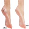 8 in 1 Foot File Kit Professional Pedicure Foot Rub Tool, Colossal Foot Dead Skin Remover Foot Scrub Care Tool for Feet, Callus Remover and Pedicure Exfoliator Tool for Women Men Gift, Green view 2