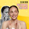 Biosulfur Grisi Acne Treatment Soap: Deep Cleansing, Acne-Fighting, Reduces Inflammation, Prevents Breakouts, Blackheads, Excess Oil, Sulfur Soap Bar, 4.4 oz, 3-Pack view 2