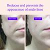BLUMBODY Smile Line Patches  Face Wrinkle Patches for Fine Lines Around Mouth, between Eyes  Non-Silicone Anti-Wrinkle Facial Tape  Comfortable Overnight Use (90-Day Supply) view 2