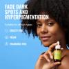 Good Molecules Discoloration Correcting Serum - Tranexamic Acid and Niacinamide Serum to Target Dark Spots and Hyperpigmentation - Skin Care for Face view 2