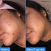 Good Molecules Discoloration Correcting Serum - Tranexamic Acid and Niacinamide Serum to Target Dark Spots and Hyperpigmentation - Skin Care for Face view 3