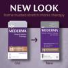 Mederma Stretch Marks Therapy - Prevents & Treats Stretch Marks, Safe for Pregnancy & Breastfeeding, Hydrates & Nourishes Skin, 5.29 oz (150g) view 4