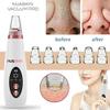 Blackhead Remover Pore Vacuum & Pore Cleaner - Nuaskin Upgraded Pimple & Acne Removal Tool for Blackhead & Whitehead Acne - Face Pore Vacuum with 6 Suction Heads, Adjustable Suction, USB Rechargeable view 4