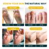 FOOT CURE Citrus Detox Foot Soak with Epsom Salts  for Foot Callus, Damaged Toenail Appearance, Pedicure Spa, and Soothing Sore, Tired Feet - 16 oz (Pack of 1) view 3